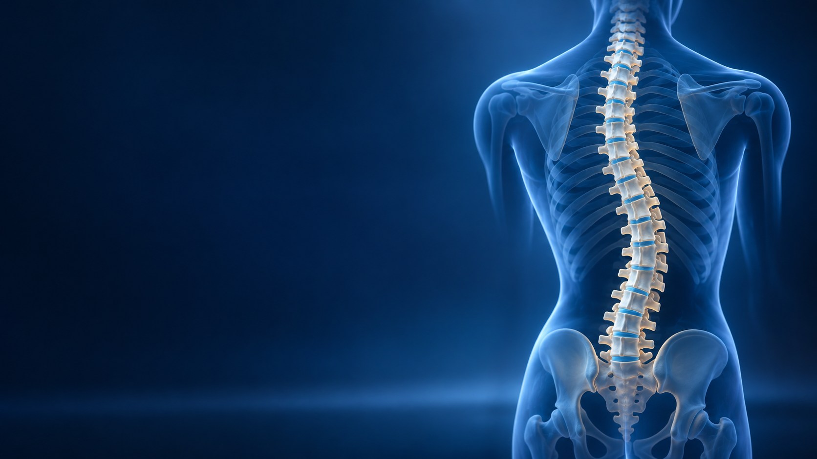 3D scoliosis spine anatomy illustration